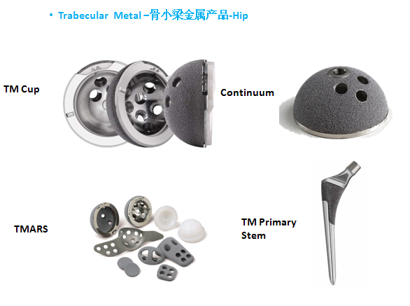 骨小梁金属产品关节trabecularmetal
