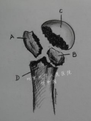 肱骨近端四部分解剖