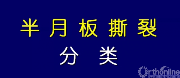 半月板撕裂的分类及MR的诊断要点 | 骨科在线