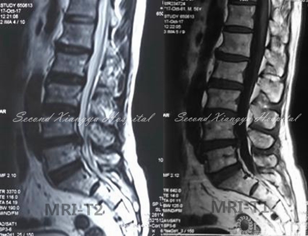 6-7MRI.jpg