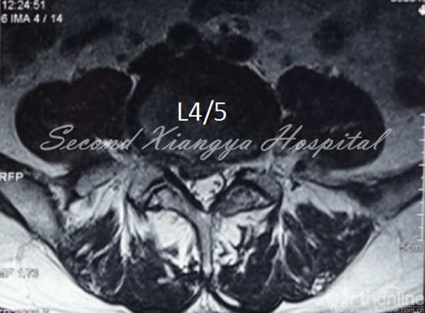 8MRI-TRANSVERSE_副本.jpg