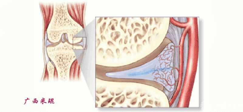 米琨:半月板的血供与临床