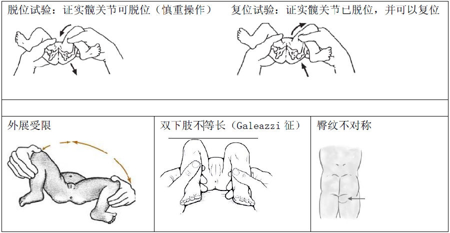 小于3个月的新生儿及婴儿:最简单和基本的手法--做屈髋外展活动.