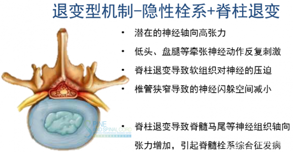 脊髓栓系症状图片