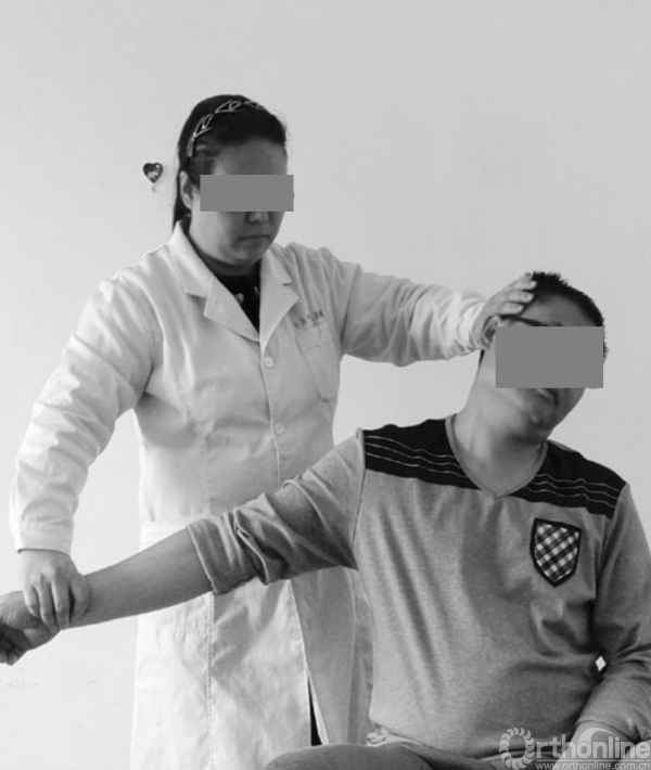 11种临床常用的颈部特殊检查你get了吗