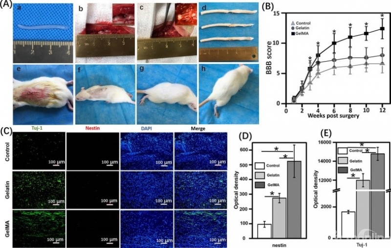 苏大附一院陈亮团队构建仿生水凝胶纤维束促进脊髓修复