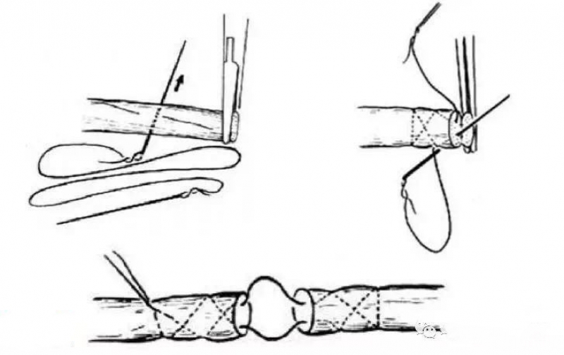 缝合法krackow 缝合法(1)开放式手术近年来跟腱的缝合法并无太多更新