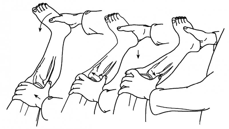 ①macintosh轴移试验:(3)轴移试验在进行lachman试验和前抽屉试验检查