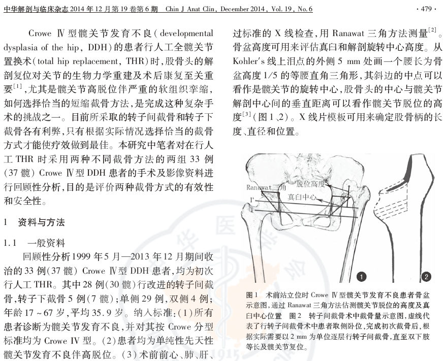 术中不同截骨方式行股骨短缩治疗croweⅣ型髋关节发育不良的疗效分析