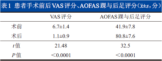 heppleⅤ型距骨骨软骨损伤的手术治疗