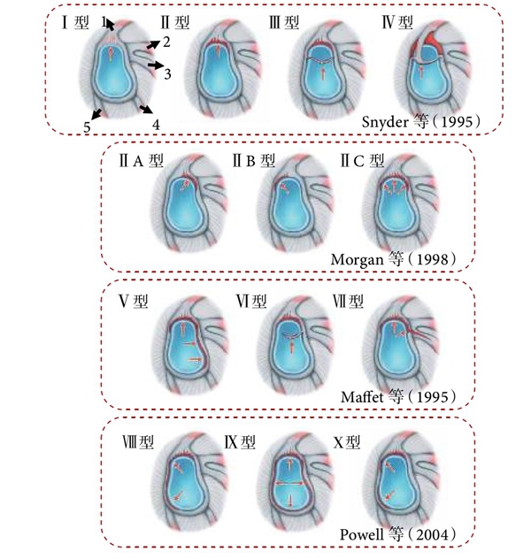 肩关节不稳与slap损伤联系的研究进展