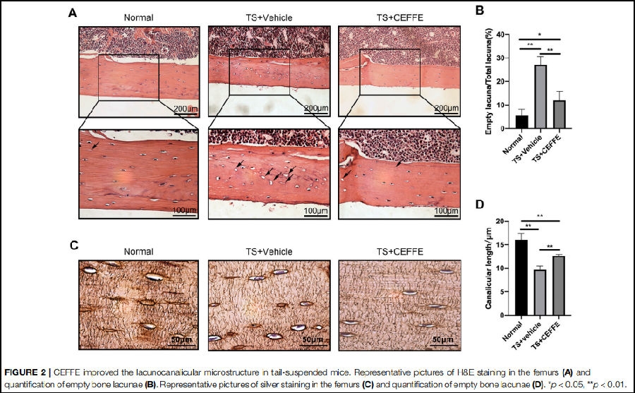 股骨空骨陷窝定量分析另外,研究团队还对ceffe改善骨质疏松的潜在机制